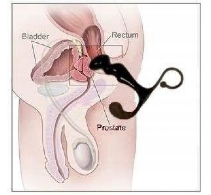 Массажер простаты ToyJoy Power Plug Prostate Massager, красный